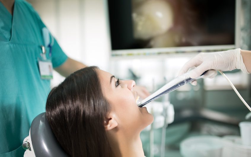 Combien coûte la procédure des facettes dentaires en Turquie ?